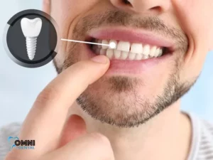All-on-4 Dental Implants in Arlington Heights