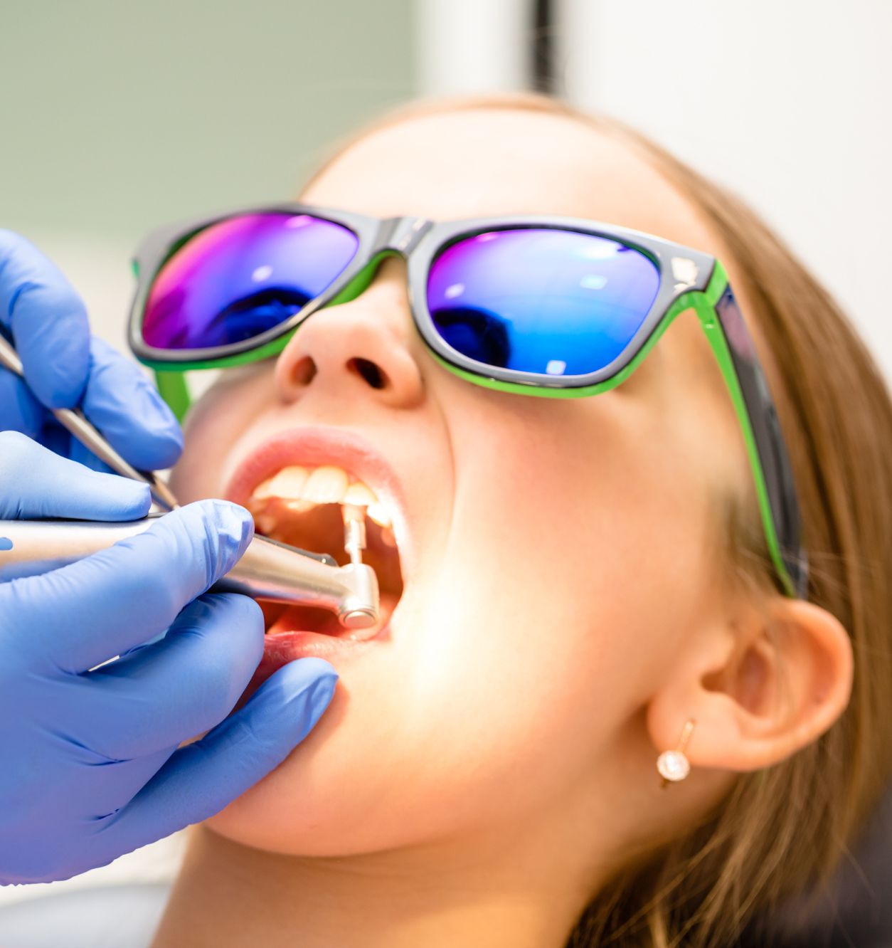 Benefits of Deep Teeth Cleaning