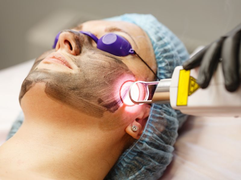Skin Rejuvenation Services