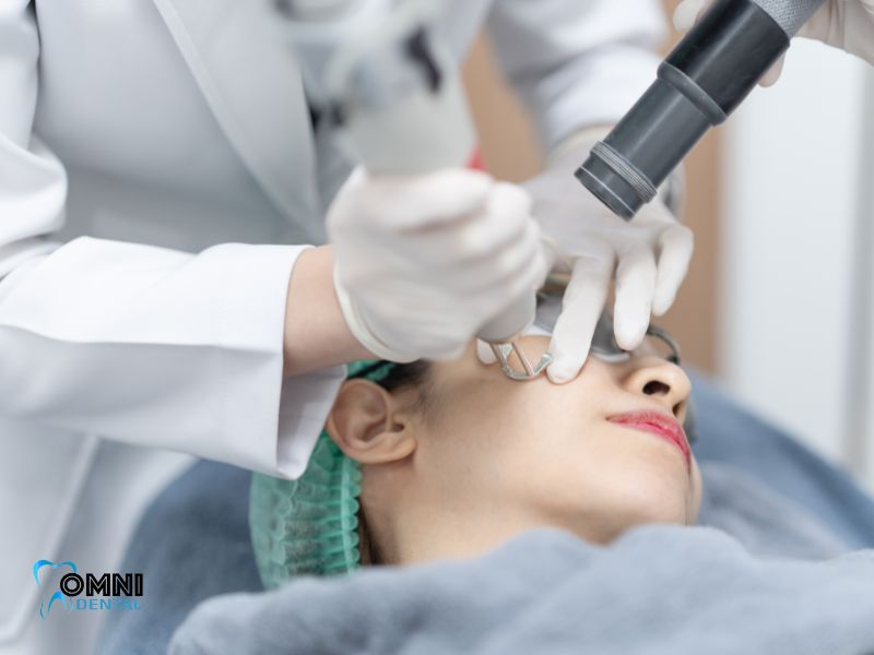 laser treatments