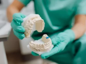How Dental Implants Improve Your Facial Structure