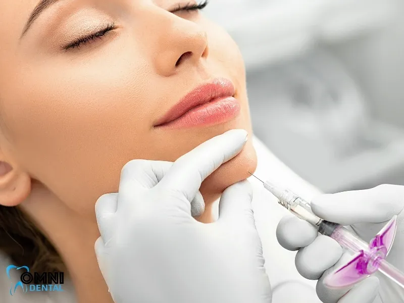 How Long Do Dermal Fillers Last in the Face