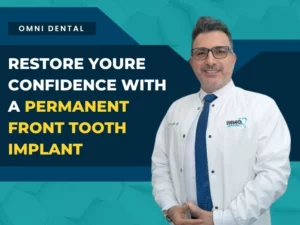 Front Tooth Dental Implant