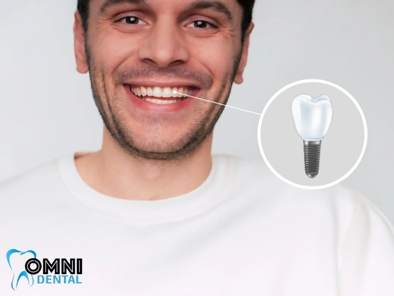 Common Problems and Failure Rate