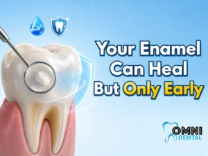 Can You Reverse Tooth Decay Naturally