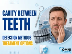 Cavity Between Teeth-Detection and Treatment