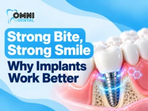 How Dental Implants Improve Your Bite Strength